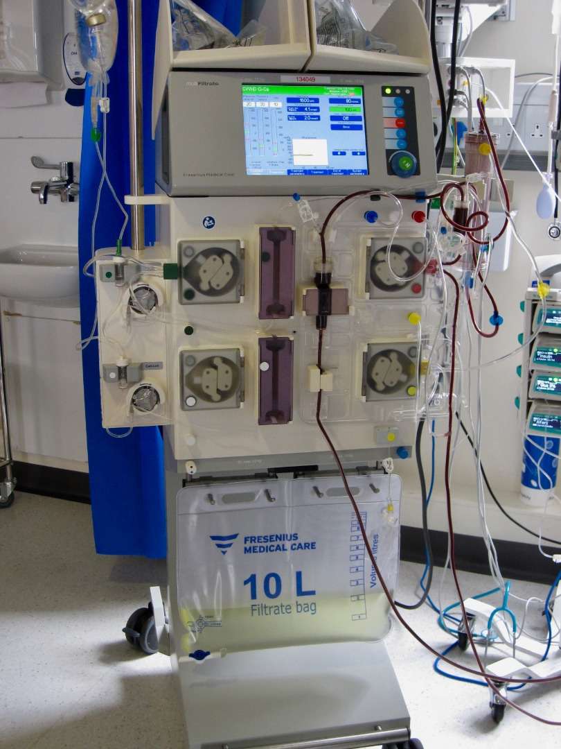Dialysis Crisis at Parirenyatwa: Patients Left Stranded as New Machines Sit Idle